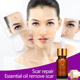 Skin Repair Essential Oil